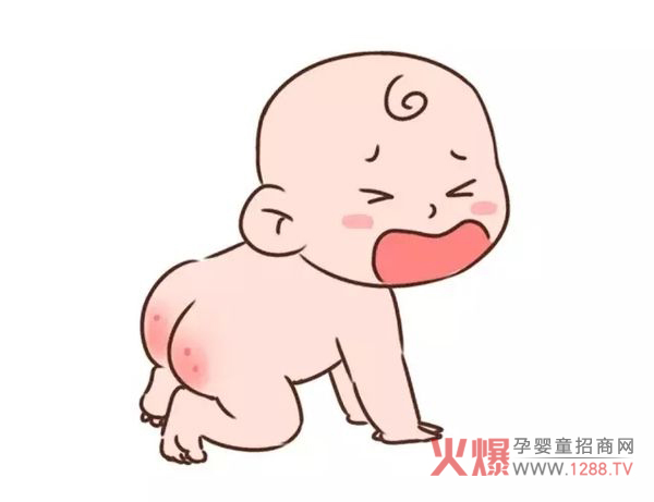 向太陽古方七草護(hù)臀膏 7大草本成分安全護(hù)臀